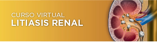 Curso virtual Litiasis renal